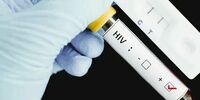В Самарской области хотят включить тест на ВИЧ в ежегодную диспансеризацию
