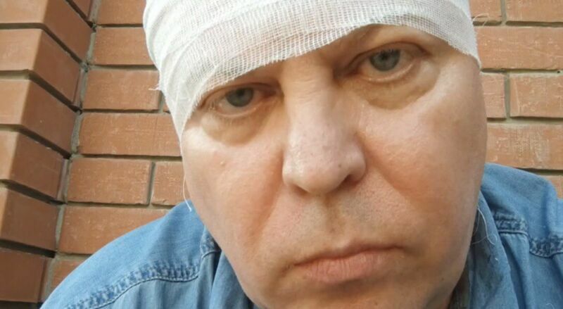 Суд начал пересматривать дело о нападении на депутата Матвеева